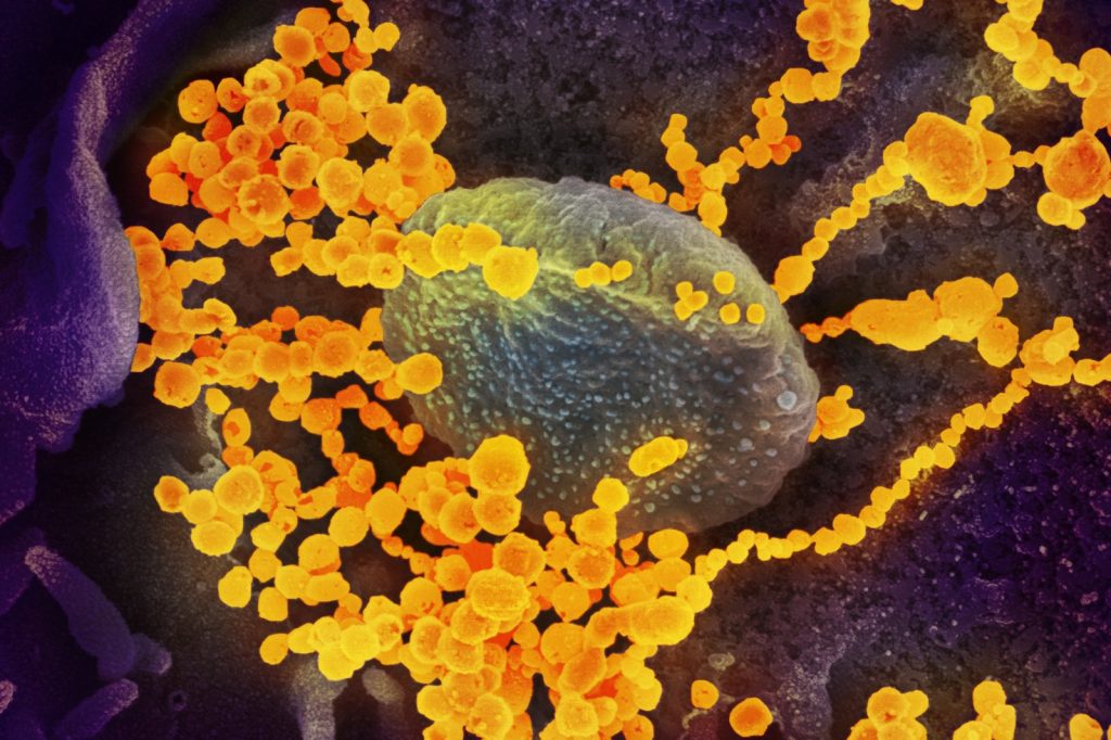 Study Suggests COVID-19 Infection May Offer Protection Against Reinfection
