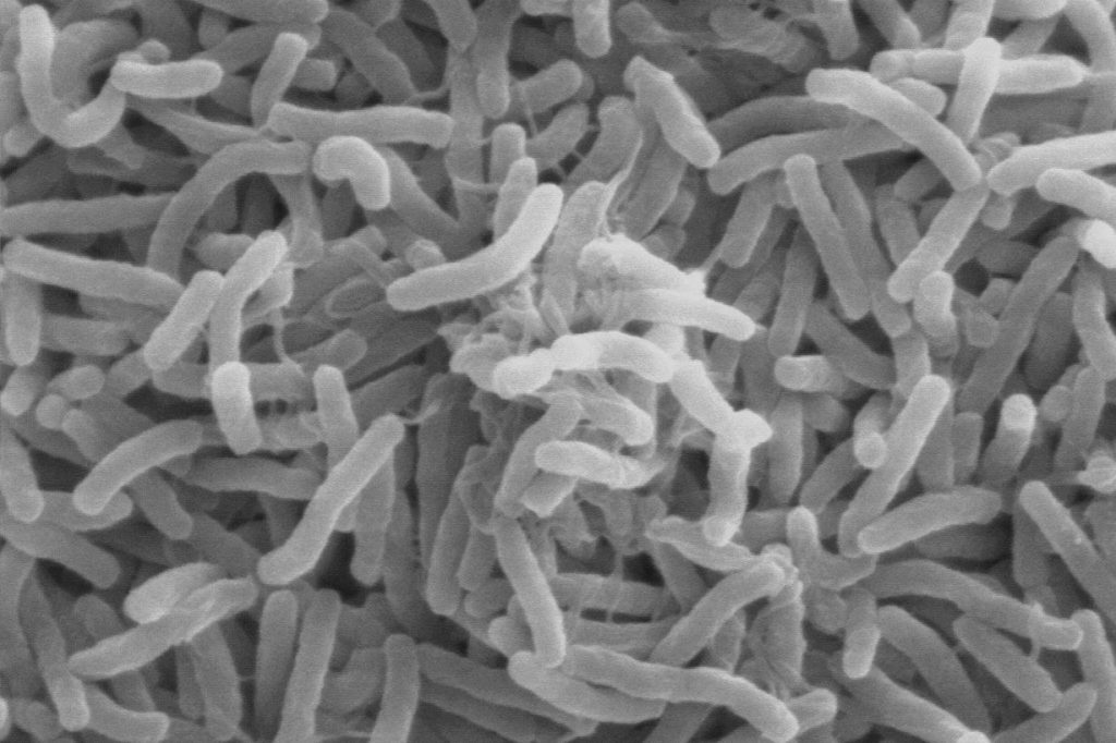 2022 cholera outbreak in Lebanon