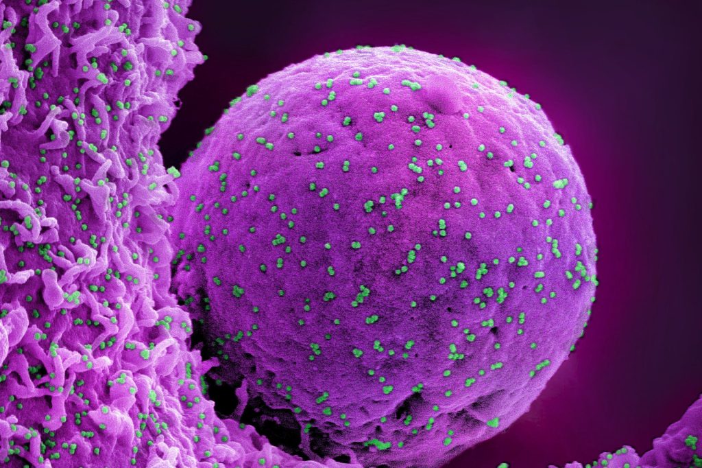 BA.2.86 heavily-mutated Omicron subvariant sparks global health concern
