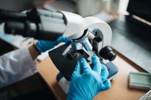 Researchers Identify Lupus Root Cause, Potential Cure