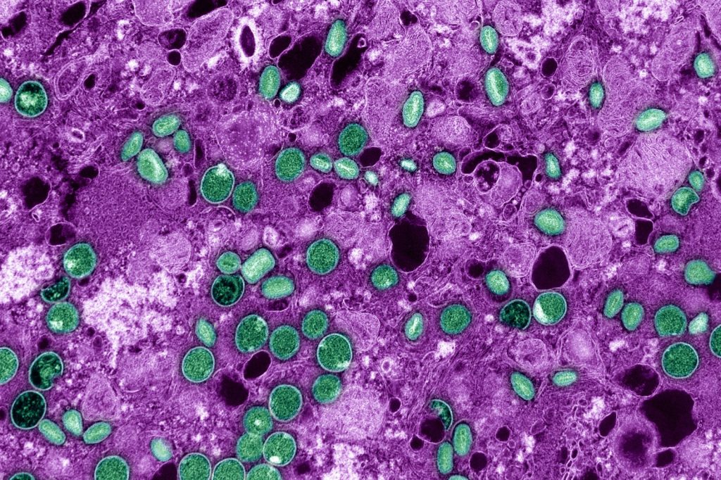 Mpox Epidemic Surpasses 29,000 Cases in Central Africa Region