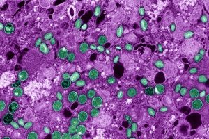 Mpox Epidemic Surpasses 29,000 Cases in Central Africa Region