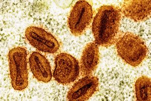 Gabon confirms first mpox case after man flew from Uganda.