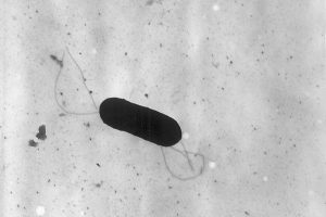 Listeria Outbreak Kills Infant, Sickens 10 in California