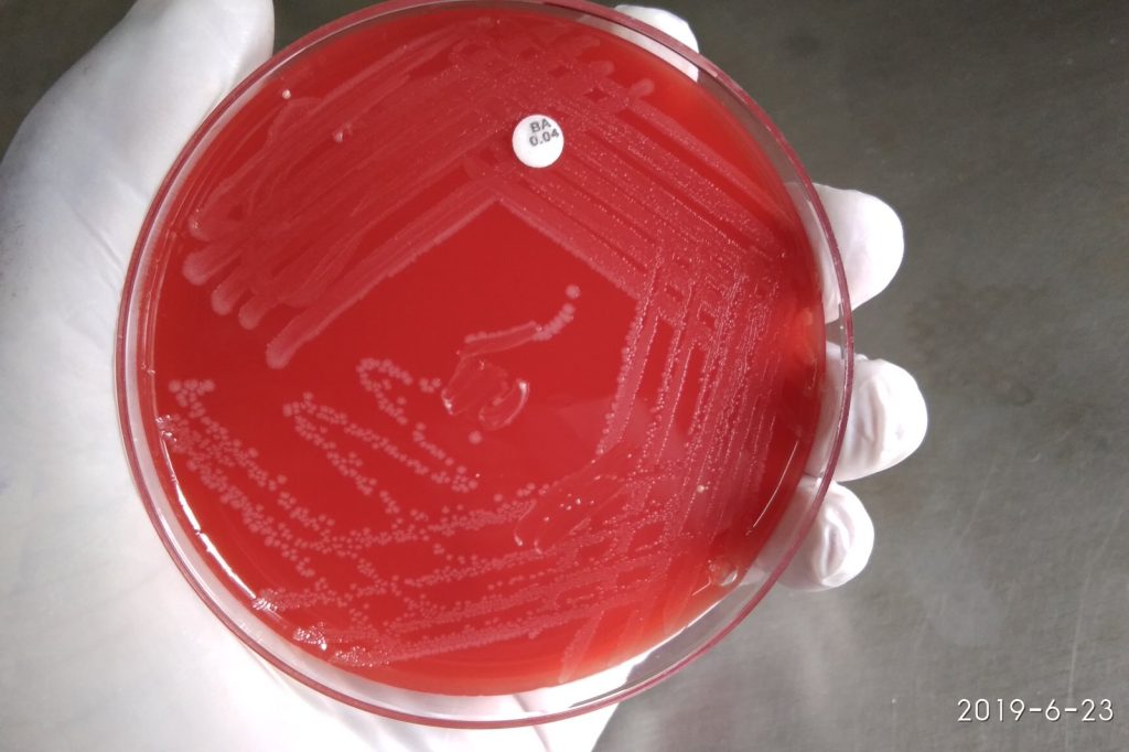 Listeria Outbreak Kills Infant in California