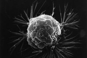 November 2024 Deaths Highlight Ongoing Fight Against Cancer