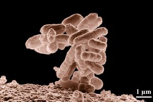 E. coli Outbreak Linked to Organic Carrots in the US