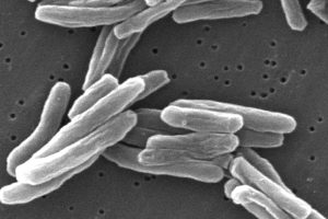 John Green’s New Book Tackles Tuberculosis Epidemic Head-On Suddenly