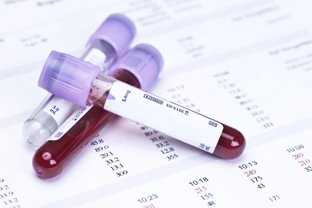 GDF15 Blood Protein May Warn of Dementia Decades Before Symptoms
