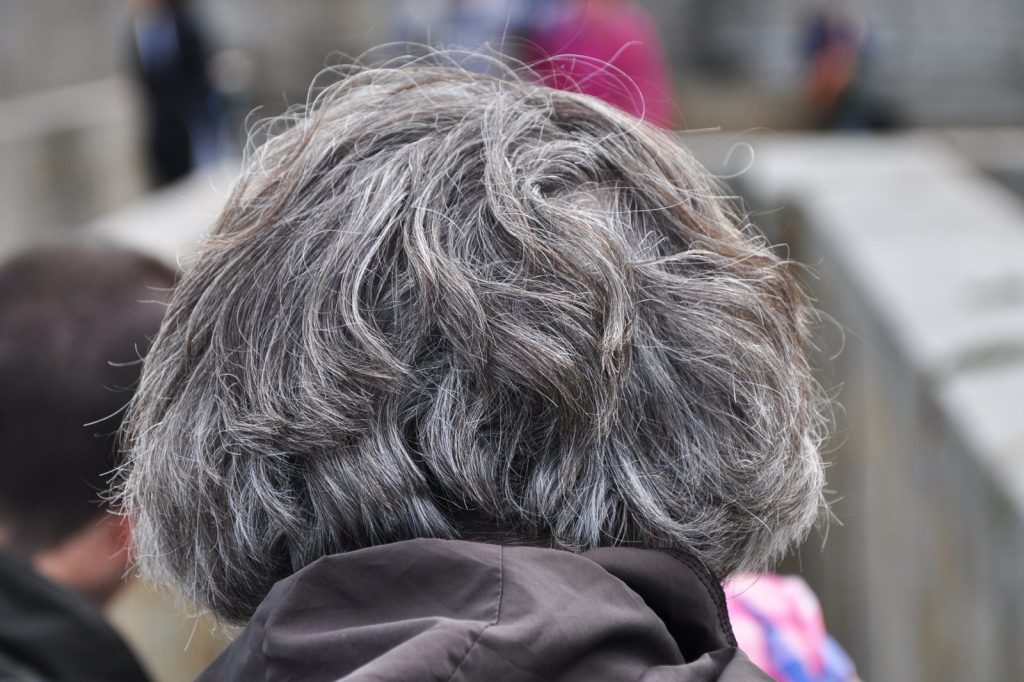 Grey hair in your 20s, poor memory in your 30s? Neurologists