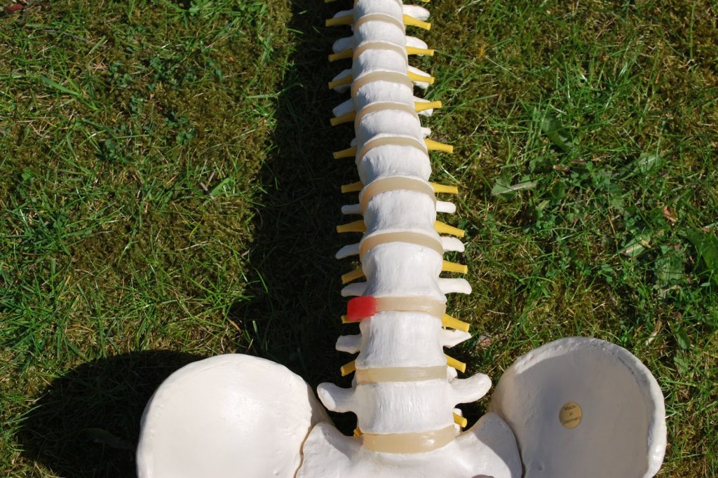Pain Psychologist\u2019s Own Paralysis Led to New Understanding of Chronic Pain