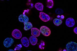 USC scientists unlock endless supply of cancer-fighting immune cells