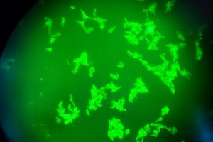 Scientists Capture 3D View of T Cells Attacking Cancer
