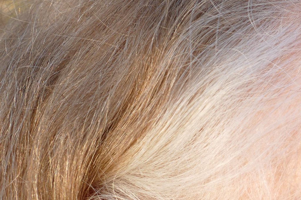 Neurologists say grey hair in 20s, memory lapses in 30s not necessarily alarming