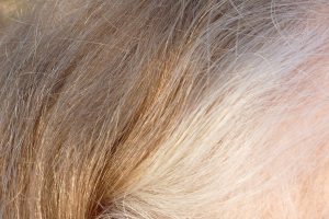 Neurologists say grey hair in 20s, memory lapses in 30s not necessarily alarming
