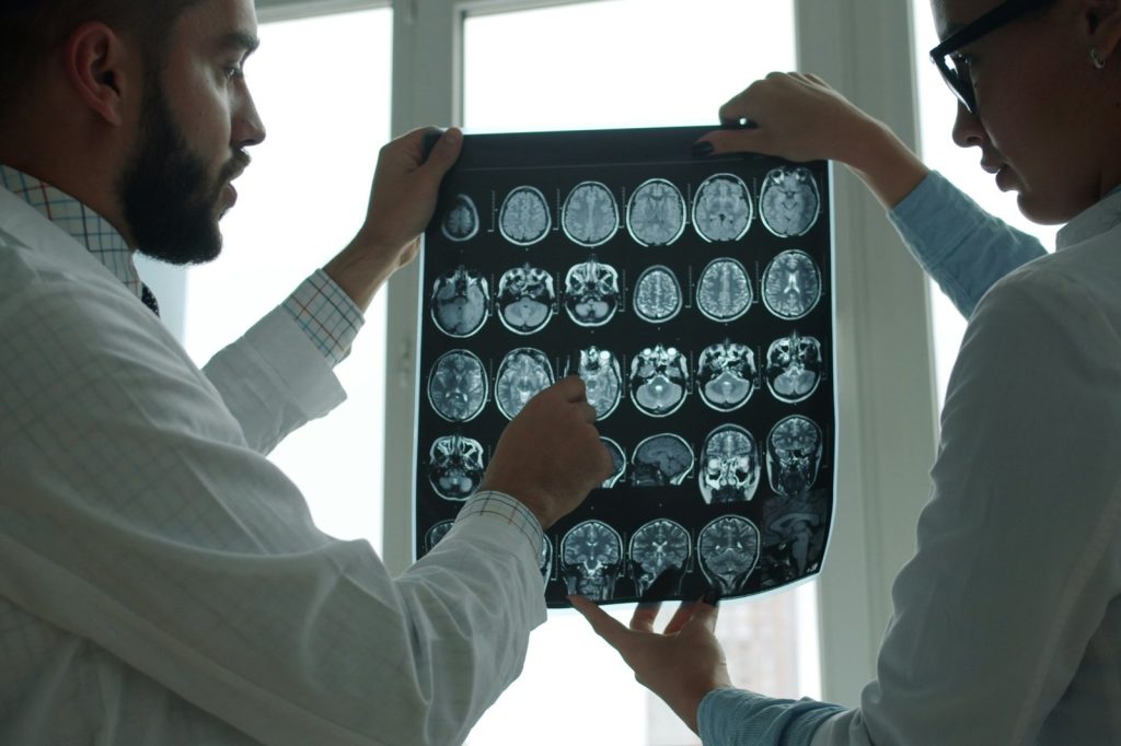 New study shows brain changes linked to dementia begin years before symptoms appear