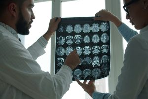 New study shows brain changes linked to dementia begin years before symptoms appear