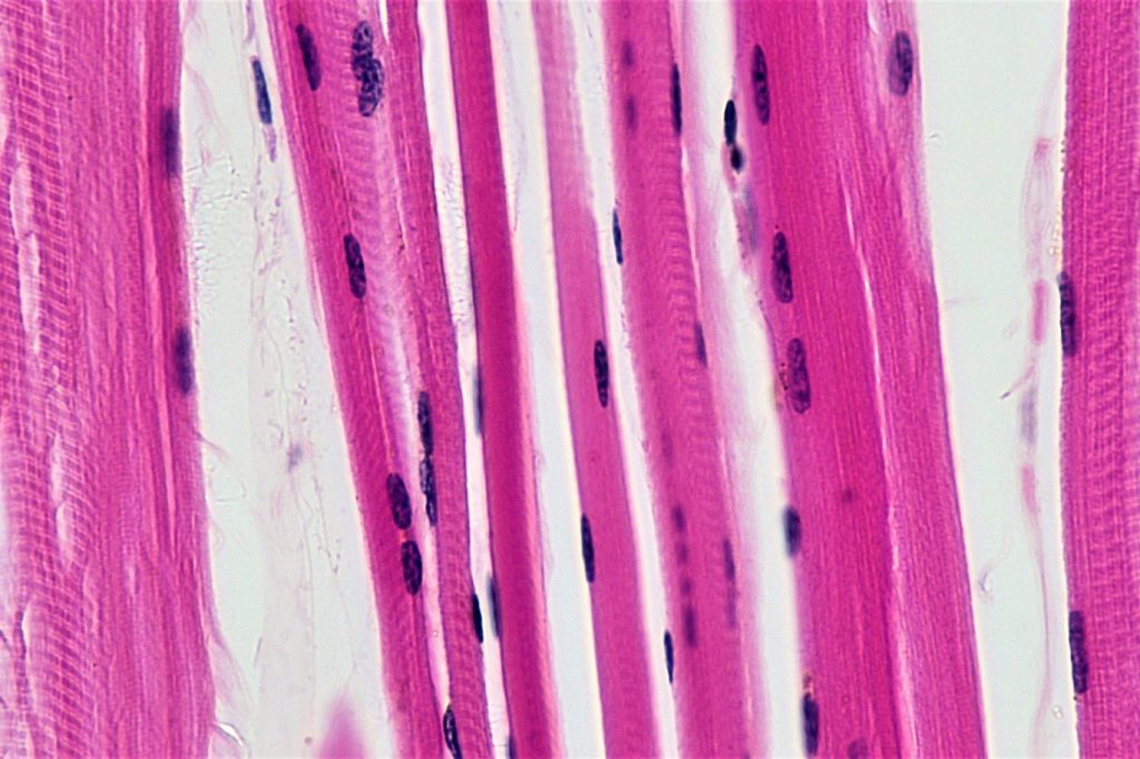 Muscle cells found to release anti-cancer signals, study reveals