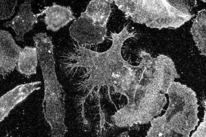 Immune System’s Key Players: Cells, Tissues, Organs