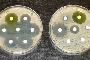 Antimicrobial resistance now a top global health threat