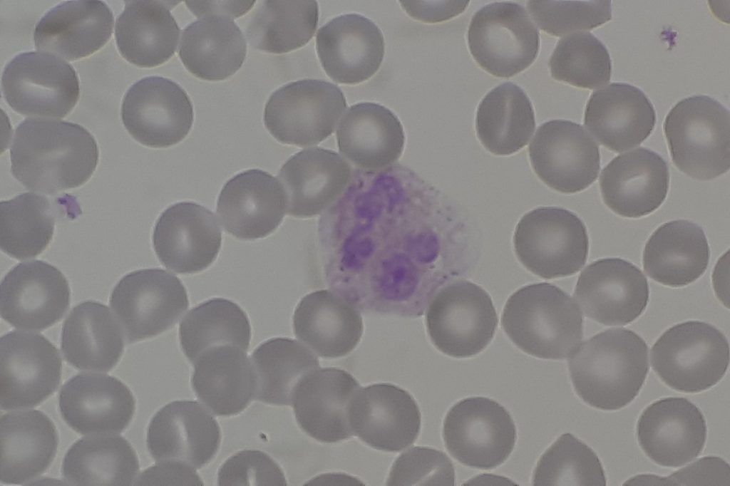 Scientists focus on immune decline in aging populations
