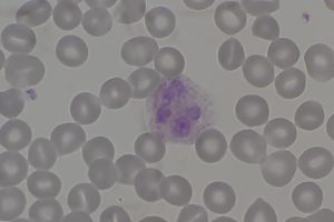 Scientists focus on immune decline in aging populations