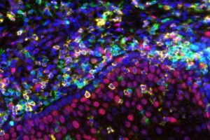 CAR-T Therapy Market: Leaders, Sales, and Global Reach in 2023