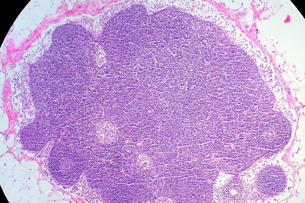 Nation Health MD Explains Lymph Supplements for Detox