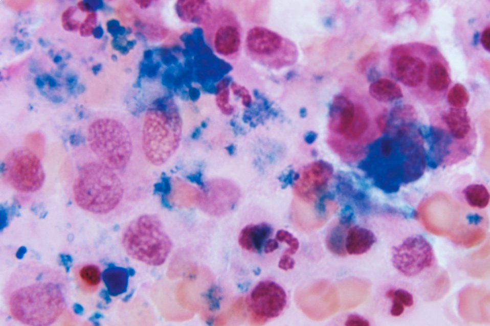 Immune System Key Organs: Bone Marrow, Thymus, Spleen