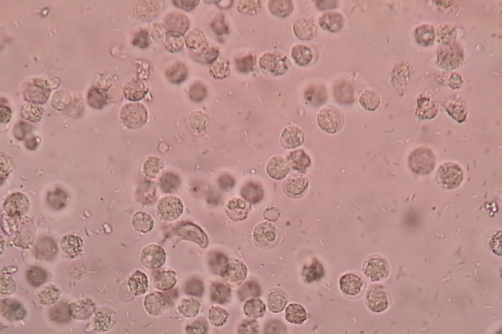 Human Immune System: How It Defends the Body Against Pathogens,