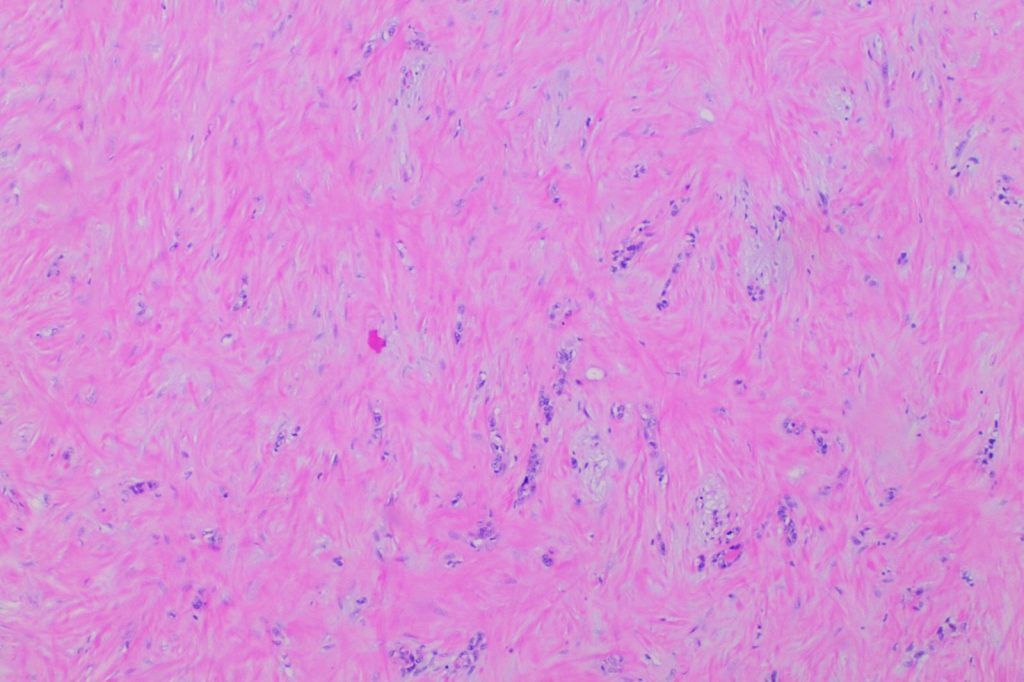 Florida A&M Researchers Test Compounds That Blocked 90% of Pancreatic Cancer Cell Movement