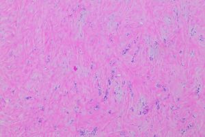 Florida A&M Researchers Test Compounds That Blocked 90% of Pancreatic Cancer Cell Movement