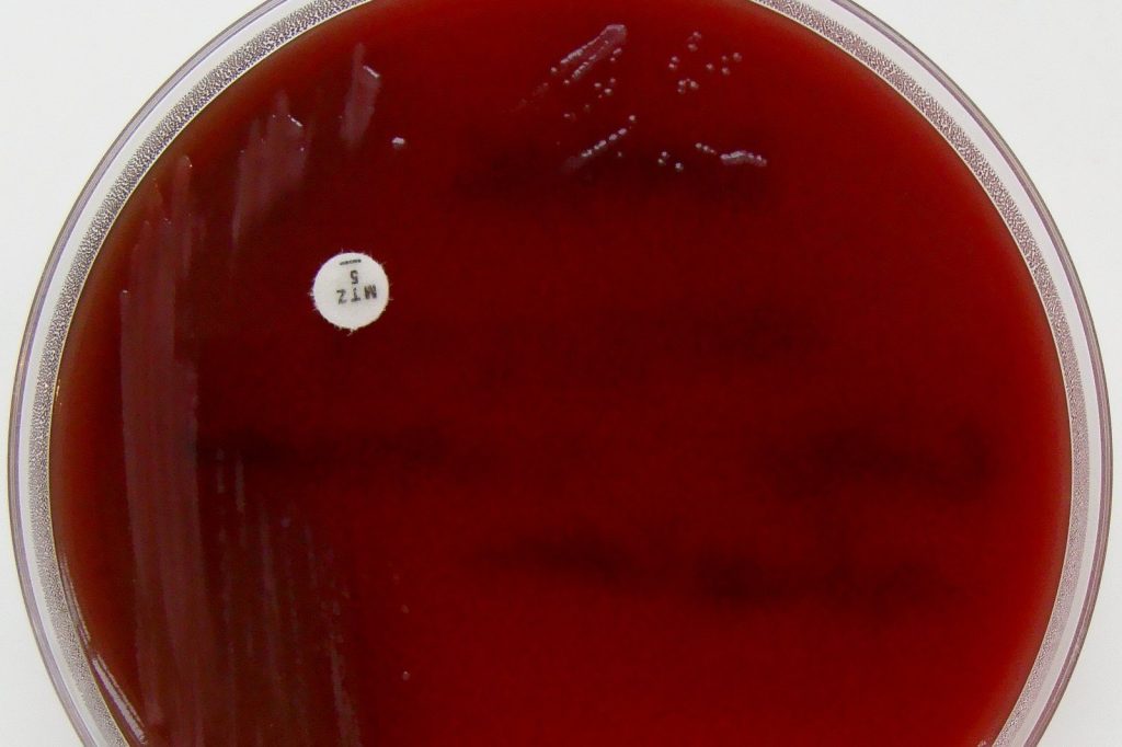 Johns Hopkins solves gut toxin mystery, opening cancer treatment path