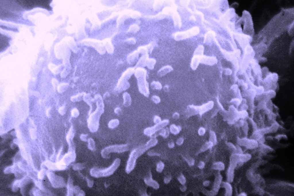 Human Immune Systems Complex Defense Network Fights Infection