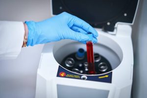 Real-World Oncotype DX Adoption: Rates and Key Challenges
