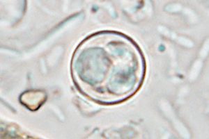 Cyclospora cayetanensis causes global produce-borne illnesses
