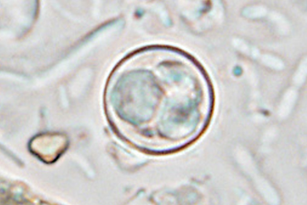 Cyclospora cayetanensis causes global produce-borne illnesses
