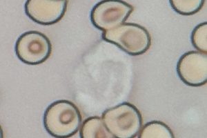 Innate Immune System Provides Immediate Defense Against Pathogens