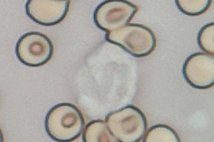 Innate Immune System Provides Immediate Defense Against Pathogens
