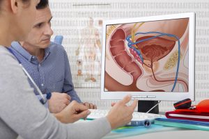 UK Funds Prostate Cancer Early Detection & Treatment