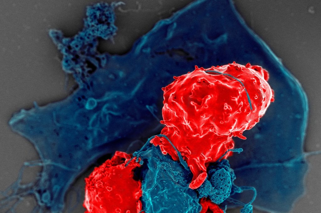 Researchers Modify Immune Protein to Fight Cancer Without Side Effects