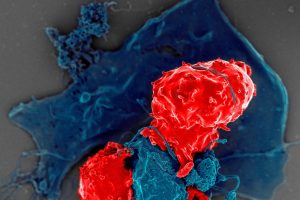 Researchers Modify Immune Protein to Fight Cancer Without Side Effects