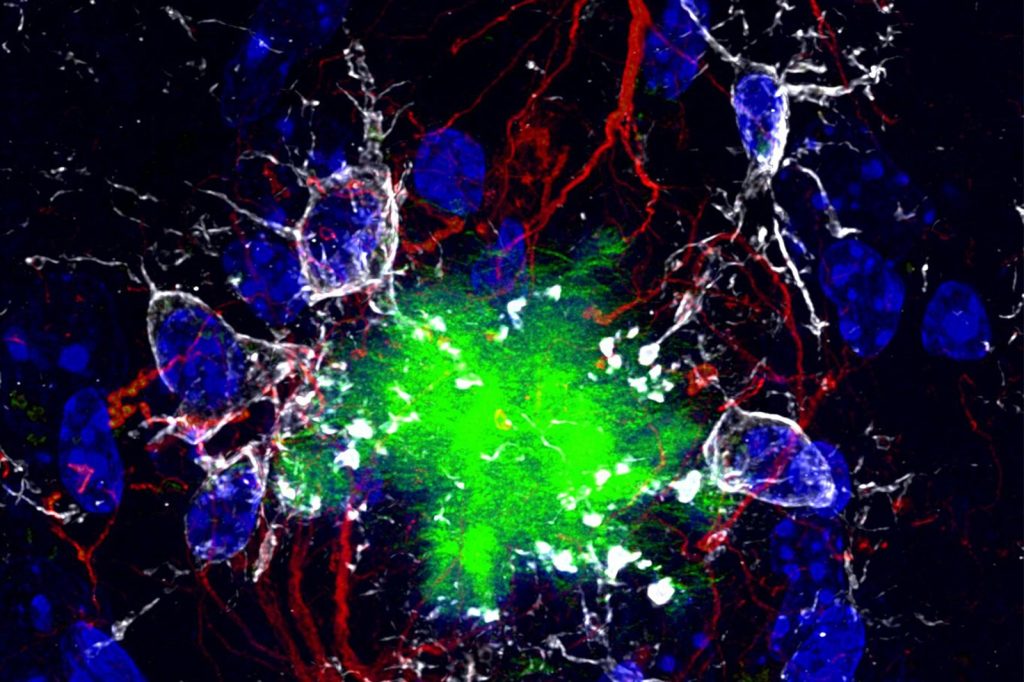 Mitochondrial Disruption and Protein Clumping Linked to Alzheimers-Like Effects
