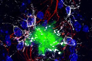 Mitochondrial Disruption and Protein Clumping Linked to Alzheimer’s-Like Effects