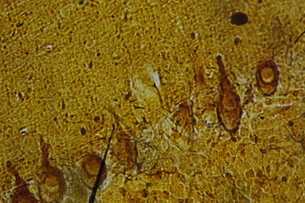 Mechanism of Brain Cell Disruption: 6PPD-Q May Trigger Alzheimers