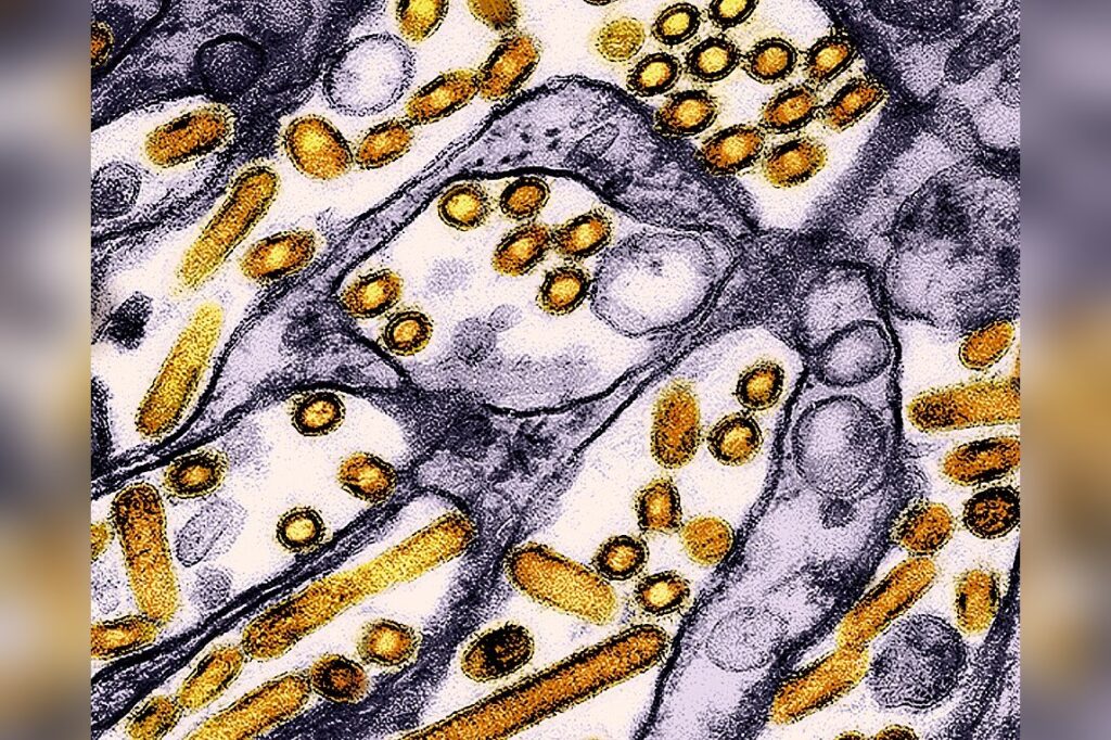Bird Flu Virus
