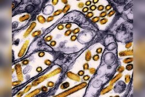 Australia Confirms First H5N1 Case, Shifts from Watchful to Active Response