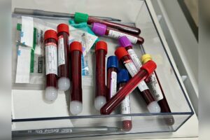 Child’s Subtle Sleep Change Led to Cancer Diagnosis After Months of Tests