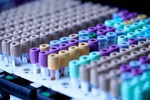 MRNA Vaccine Flips Glioblastoma Switch in 48 Hours