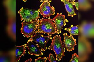 Marine-Derived Cancer Drugs Move from Ocean to Medicine Pipeline
